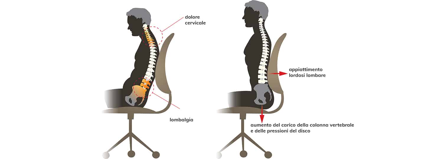 Evitare dolori alla schiena con una sedia ergonomica posturale